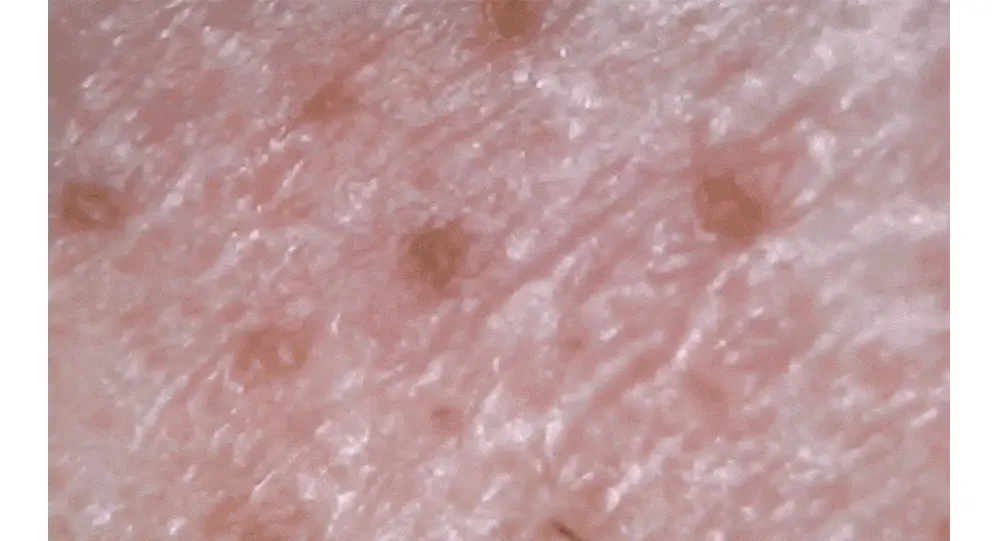 [말끔모공/블랙헤드] 성분에디터 그린토마토 모공 클렌징 오일 200ml 상세페이지 8